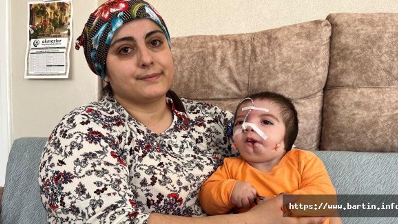 Goldenhar Sendromulu Asım Yardım Bekliyor