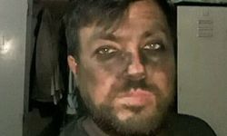 Emekliliğe hazırlanan madenci elektrik akımına kapıldı