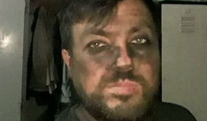 Emekliliğe hazırlanan madenci elektrik akımına kapıldı